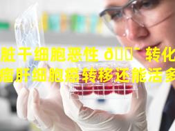 肝脏干细胞恶性 🐯 转化（恶性肿瘤肝细胞癌转移还能活多久）